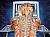   Acromion